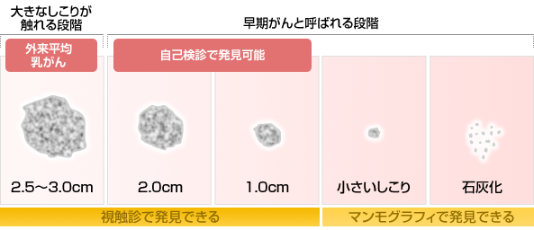 しこりの大きさと発見できる検査の種類比較表